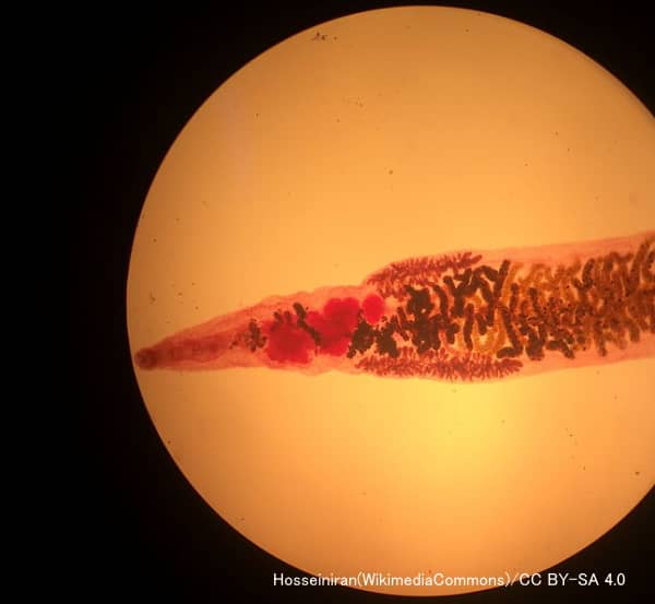 槍形吸虫(Dicrocoelium dendriticum)