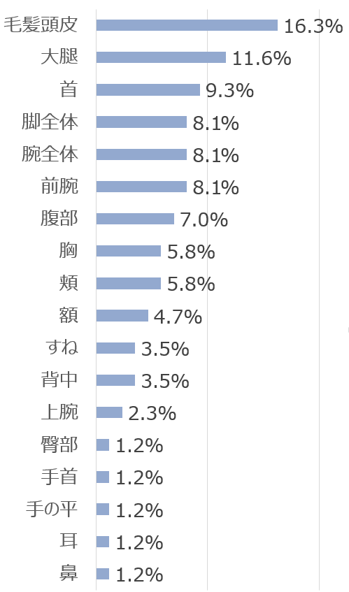 皮膚糸状菌症の好発部位