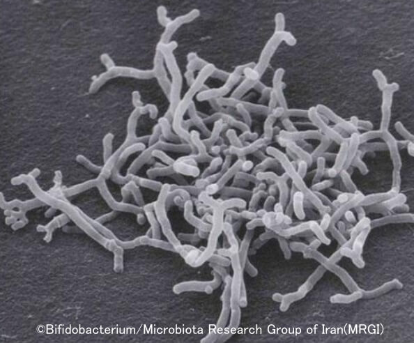 キャットフードの成分として用いられる「ビフィズス菌」の電子顕微鏡拡大写真
